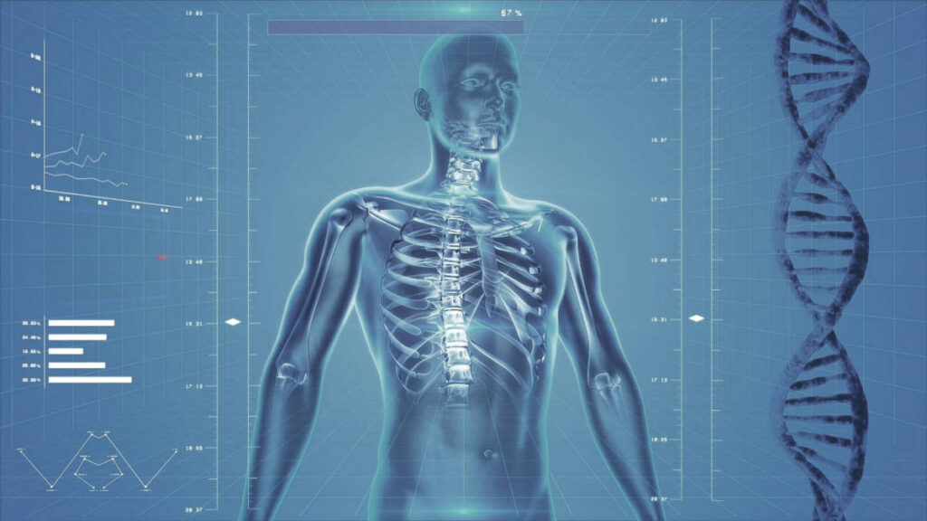 SMA mehr als eine neuromuskuläre Erkrankung?