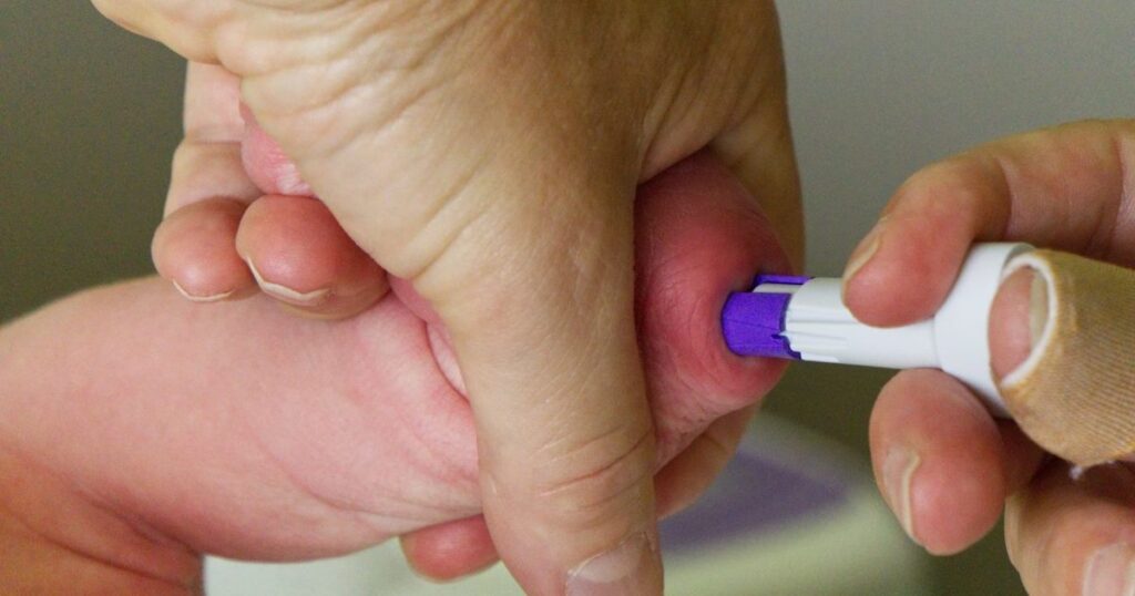 SMA in Neugeborenenscreening aufgenommen